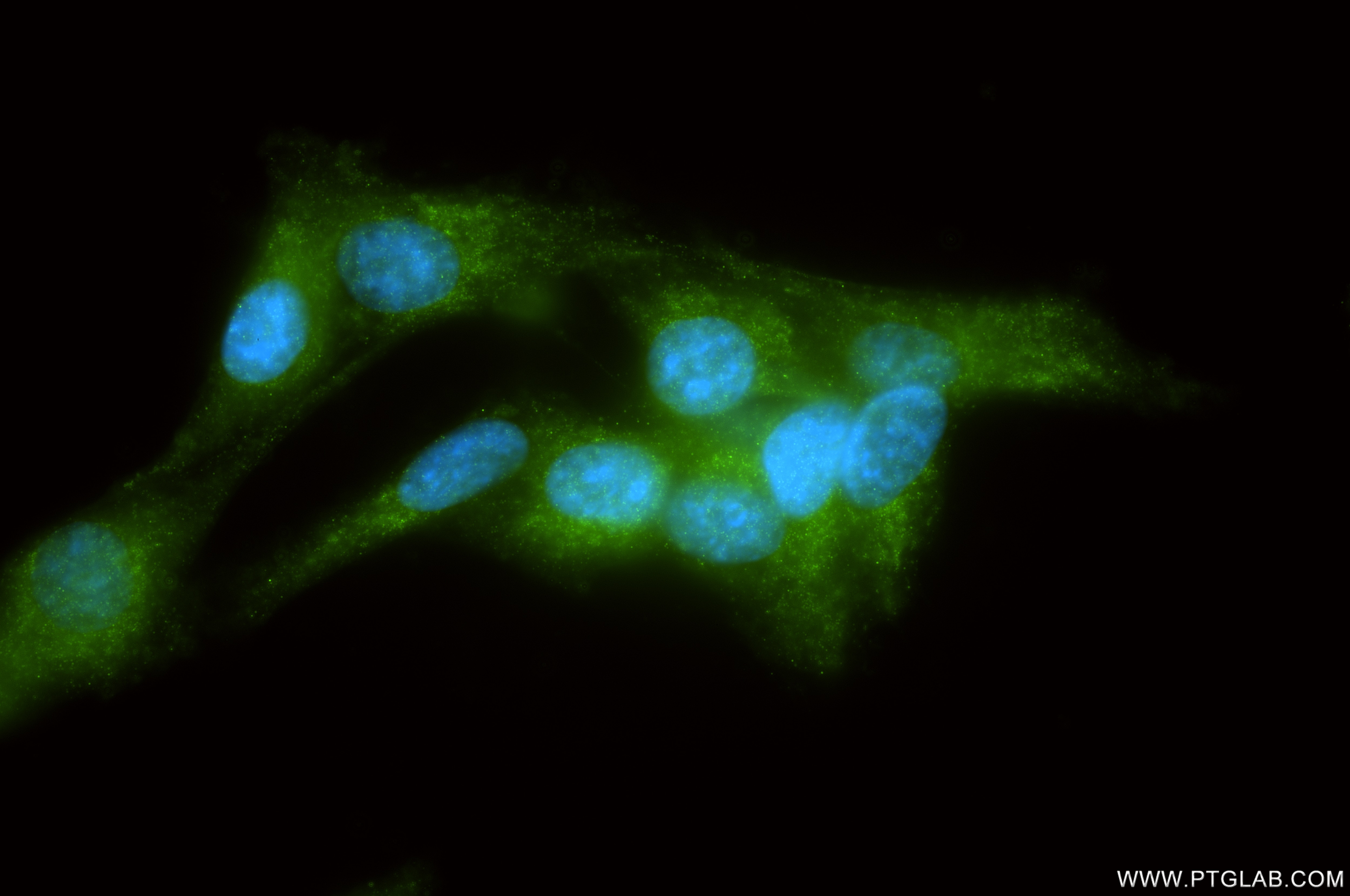 Immunofluorescence (IF) / fluorescent staining of U-87 MG cells using RPS15 Recombinant monoclonal antibody (86318-2-RR)