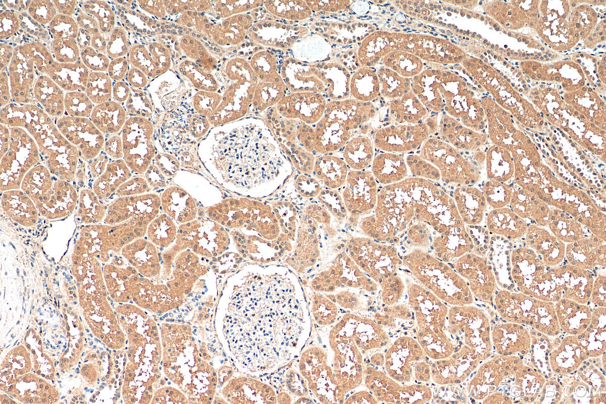 Immunohistochemistry (IHC) staining of human kidney tissue using RPS15A Polyclonal antibody (14942-1-AP)