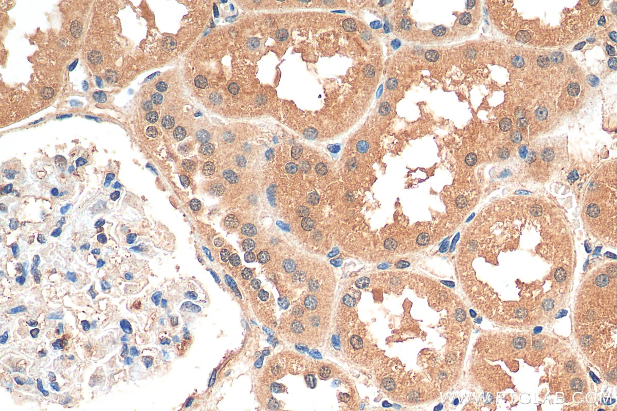 Immunohistochemistry (IHC) staining of human kidney tissue using RPS15A Polyclonal antibody (14942-1-AP)