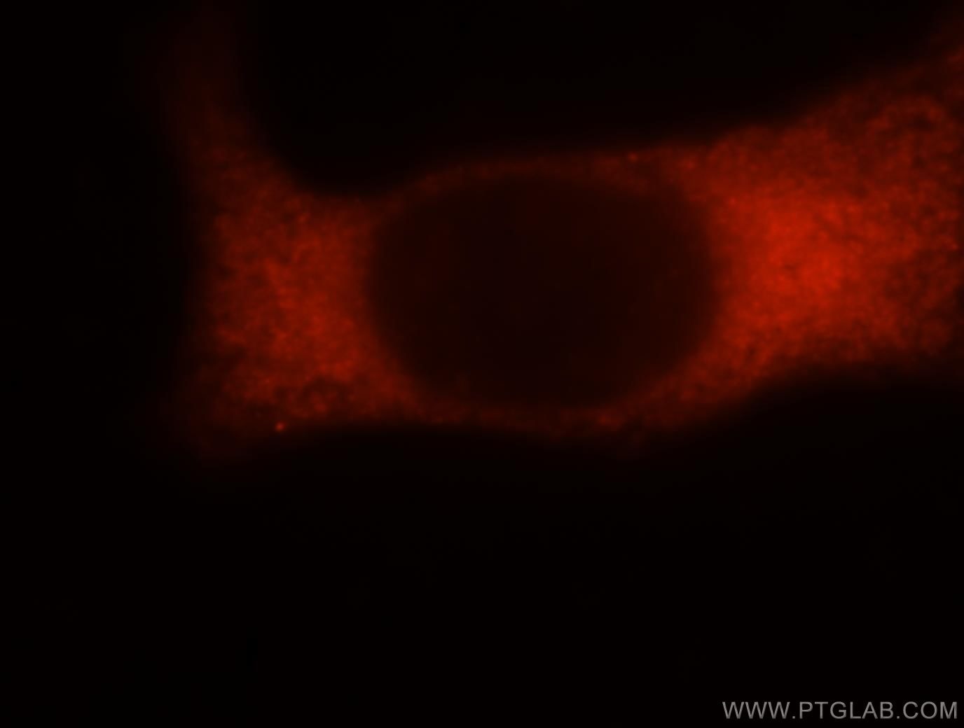Immunofluorescence (IF) / fluorescent staining of MCF-7 cells using RPS16 Polyclonal antibody (15603-1-AP)