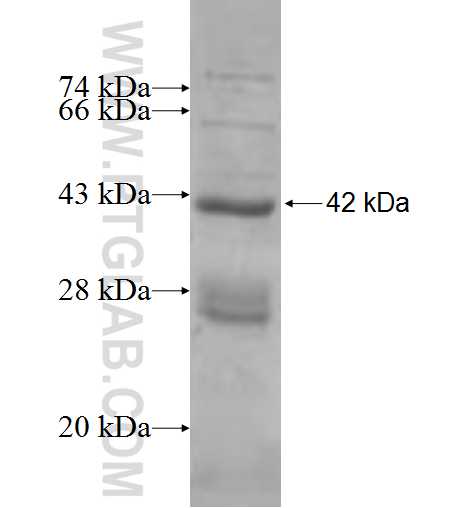 RPS16 fusion protein Ag7986 SDS-PAGE