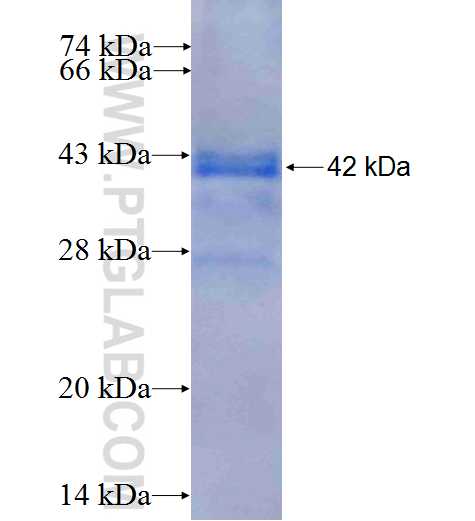 RPS17 fusion protein Ag9334 SDS-PAGE