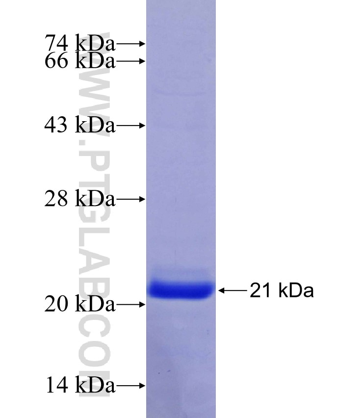 RPS18 fusion protein Ag12488 SDS-PAGE