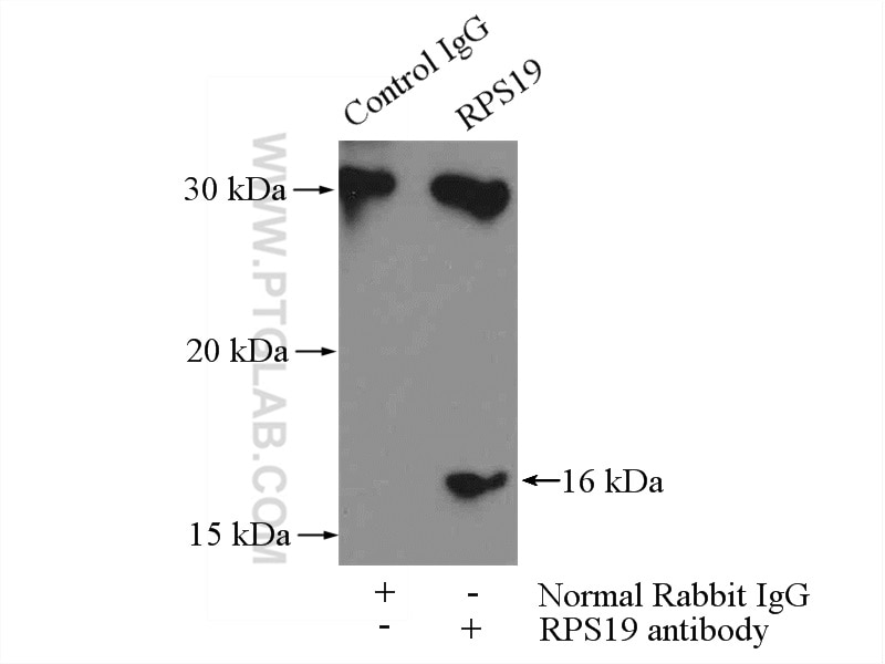 Immunoprecipitation (IP) experiment of HEK-293 cells using RPS19 Polyclonal antibody (15085-1-AP)