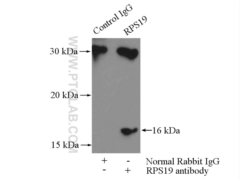 IP experiment of HEK-293 using 15085-1-AP