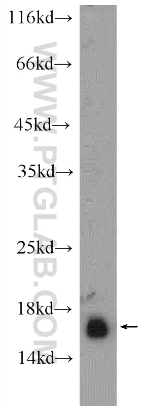 Western Blot (WB) analysis of human testis tissue using RPS19 Polyclonal antibody (15085-1-AP)