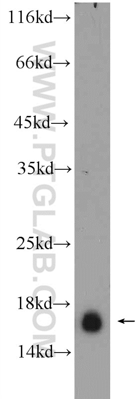 Western Blot (WB) analysis of human testis tissue using RPS19 Polyclonal antibody (15085-1-AP)