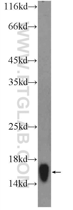 Western Blot (WB) analysis of rat colon tissue using RPS19 Polyclonal antibody (15085-1-AP)