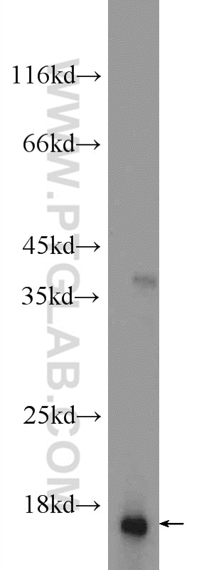 Western Blot (WB) analysis of mouse testis tissue using RPS19 Polyclonal antibody (15085-1-AP)