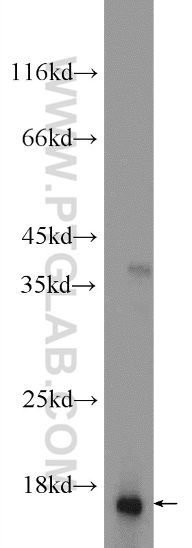 WB analysis of mouse testis using 15085-1-AP