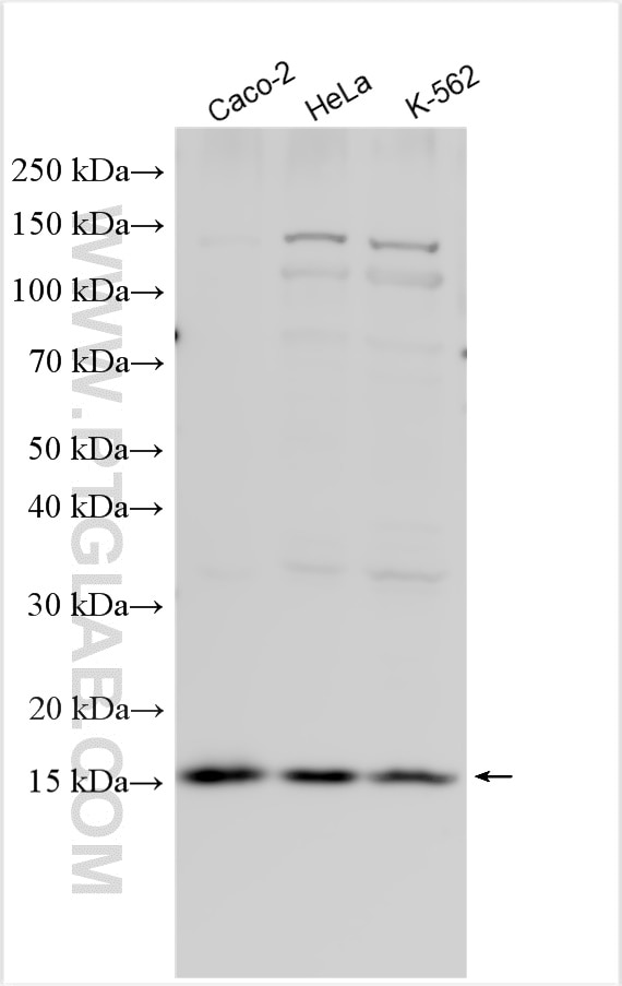 Western Blot (WB) analysis of various lysates using RPS19 Polyclonal antibody (15085-1-AP)