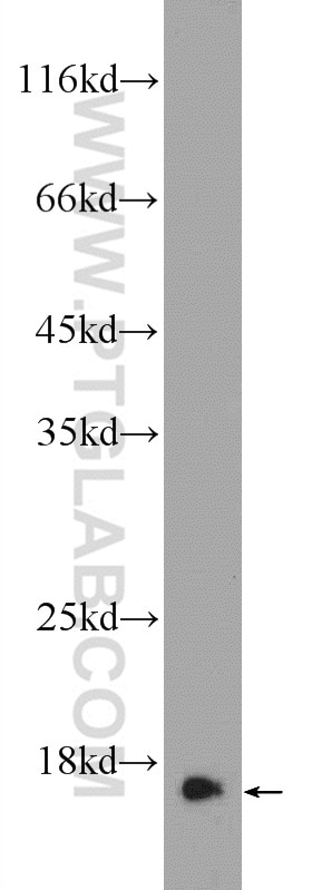 Western Blot (WB) analysis of mouse testis tissue using RPS19 Polyclonal antibody (15085-1-AP)