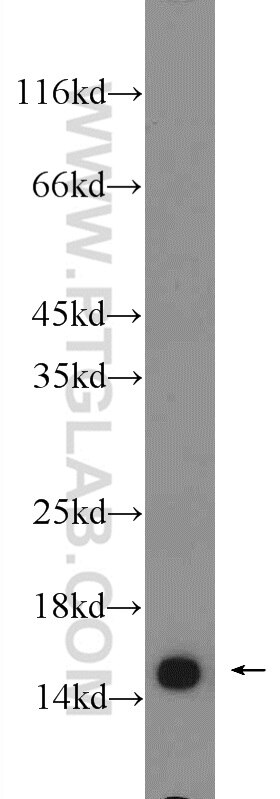 Western Blot (WB) analysis of HEK-293 cells using RPS19 Polyclonal antibody (15085-1-AP)