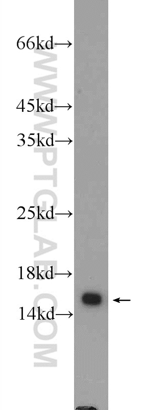 Western Blot (WB) analysis of HEK-293 cells using RPS19 Polyclonal antibody (15085-1-AP)