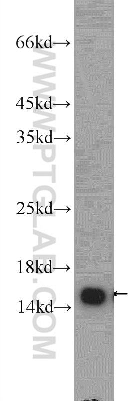 Western Blot (WB) analysis of HEK-293 cells using RPS19 Polyclonal antibody (15085-1-AP)