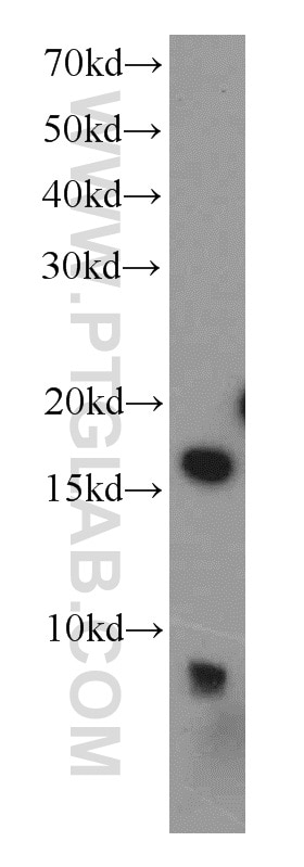 Western Blot (WB) analysis of human testis tissue using RPS19 Polyclonal antibody (15085-1-AP)