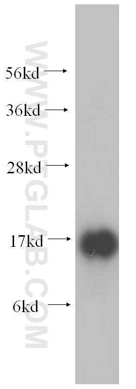 Western Blot (WB) analysis of human testis tissue using RPS19 Polyclonal antibody (15085-1-AP)