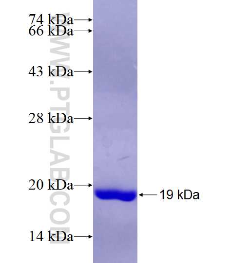 RPS19 fusion protein Ag7220 SDS-PAGE