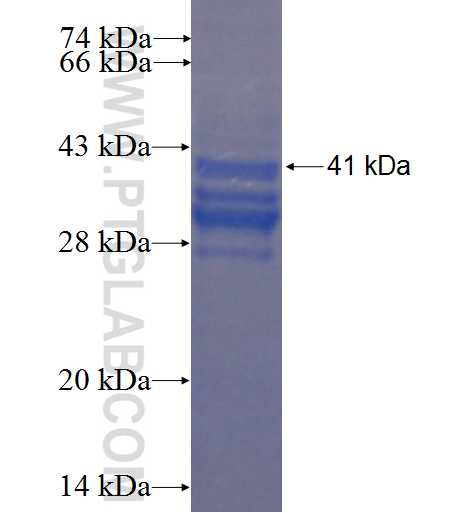 RPS19BP1 fusion protein Ag5560 SDS-PAGE