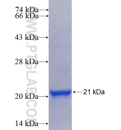 RPS19BP1 fusion protein Ag5637 SDS-PAGE