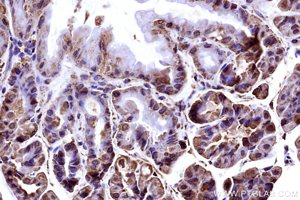 IHC staining of mouse stomach using 15562-1-AP Immunohistochemistry (IHC) staining of mouse stomach tissue using RPS2 Polyclonal antibody (15562-1-AP)