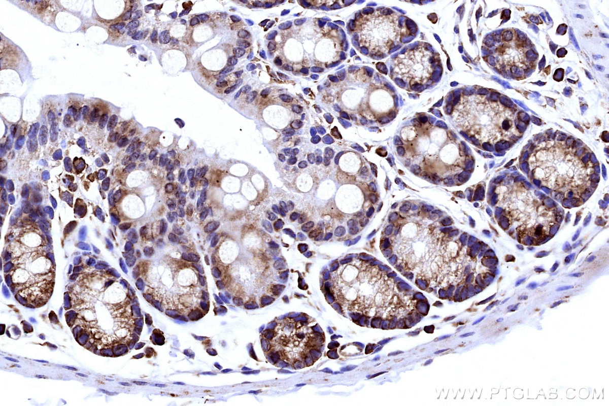 IHC staining of mouse colon using 15562-1-AP Immunohistochemistry (IHC) staining of mouse colon tissue using RPS2 Polyclonal antibody (15562-1-AP)