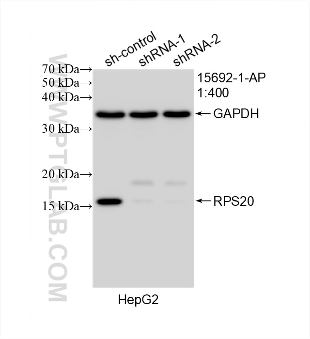 Western Blot (WB) analysis of HepG2 cells using RPS20 Polyclonal antibody (15692-1-AP)