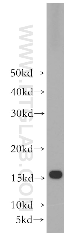 WB analysis of MCF-7 using 15692-1-AP