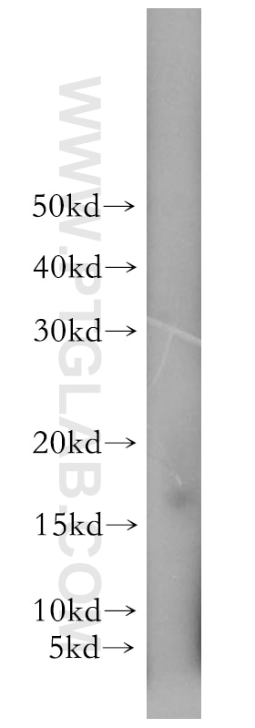 Western Blot (WB) analysis of Jurkat cells using RPS20 Polyclonal antibody (15692-1-AP)