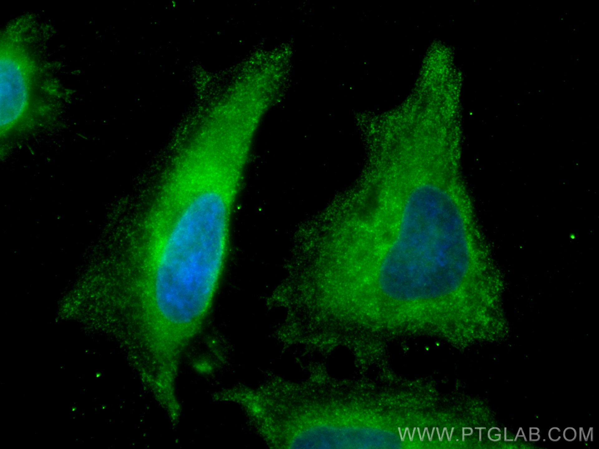 Immunofluorescence (IF) / fluorescent staining of HeLa cells using RPS20 Monoclonal antibody (68270-1-Ig)