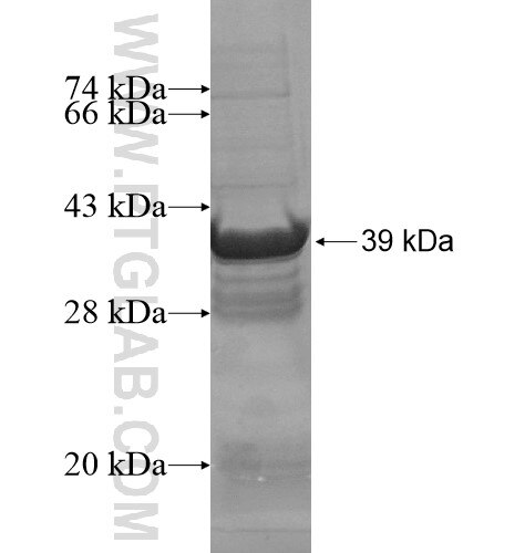 RPS20 fusion protein Ag8257 SDS-PAGE