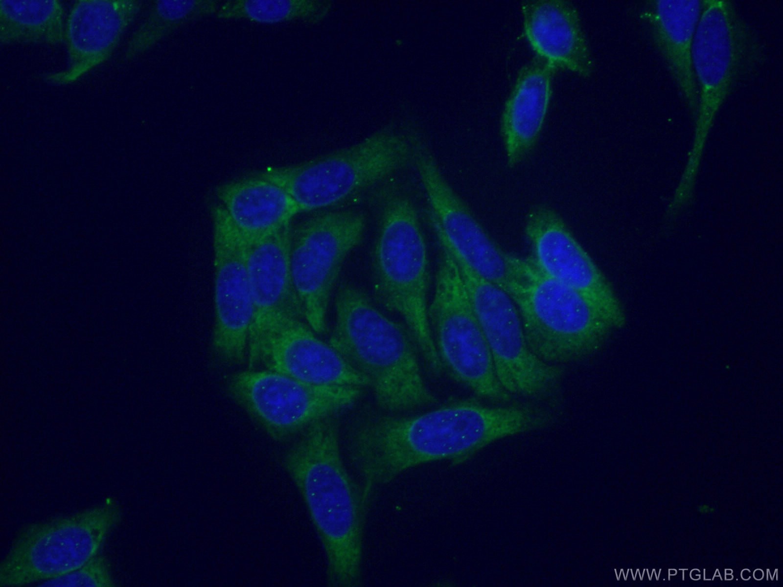 Immunofluorescence (IF) / fluorescent staining of HepG2 cells using RPS21 Polyclonal antibody (16946-1-AP)