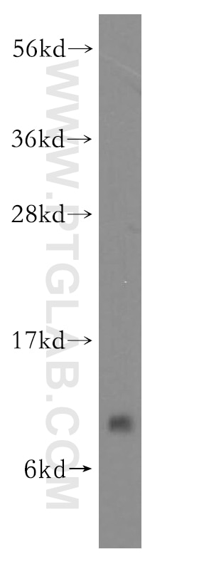 Western Blot (WB) analysis of SGC-7901 cells using RPS21 Polyclonal antibody (16946-1-AP)