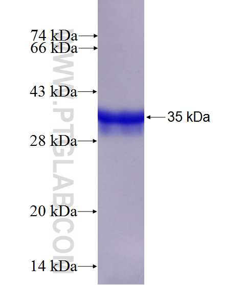RPS21 fusion protein Ag10557 SDS-PAGE