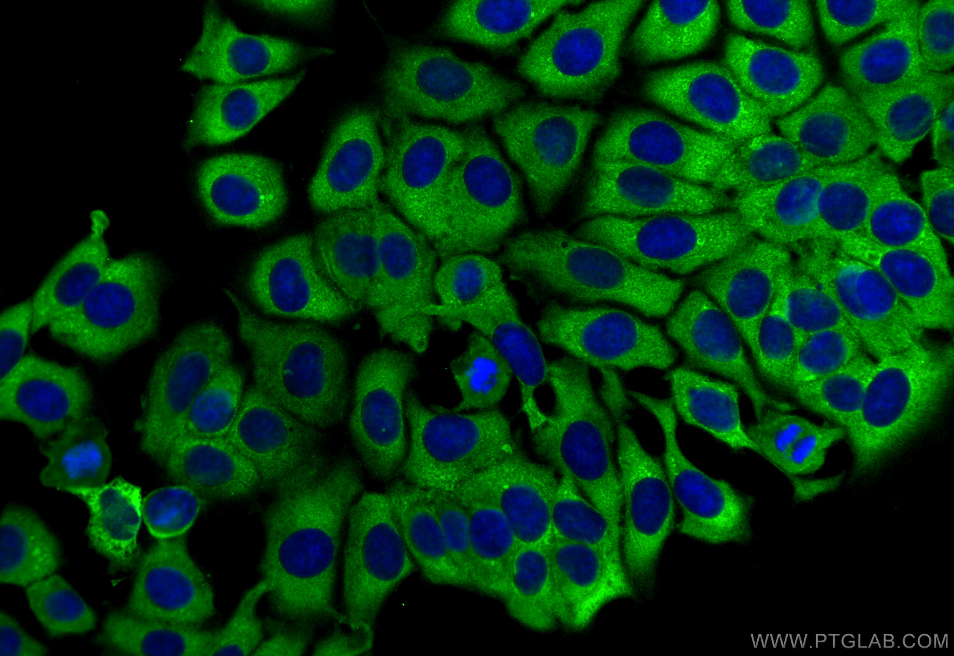 Immunofluorescence (IF) / fluorescent staining of MCF-7 cells using RPS23 Polyclonal antibody (29834-1-AP)