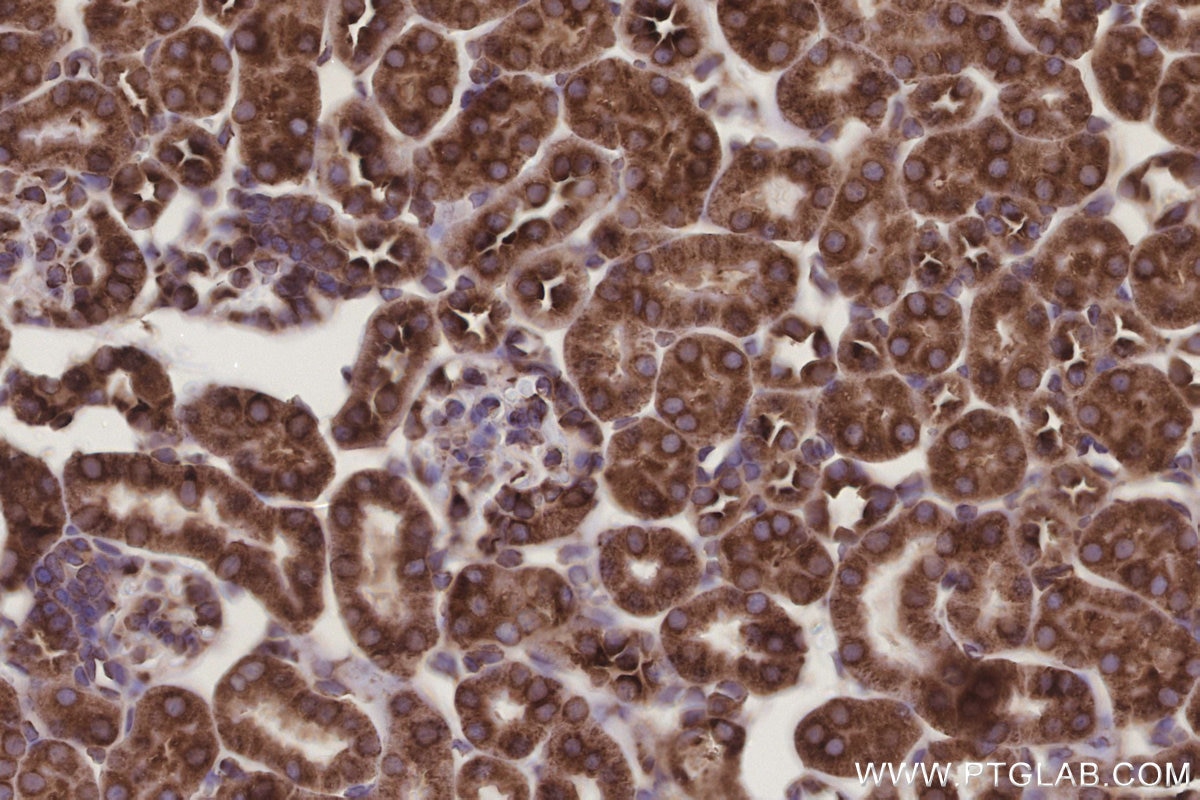 Immunohistochemistry (IHC) staining of mouse kidney tissue using RPS23 Polyclonal antibody (29834-1-AP)