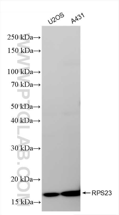 Western Blot (WB) analysis of various lysates using RPS23 Recombinant antibody (84560-1-RR)