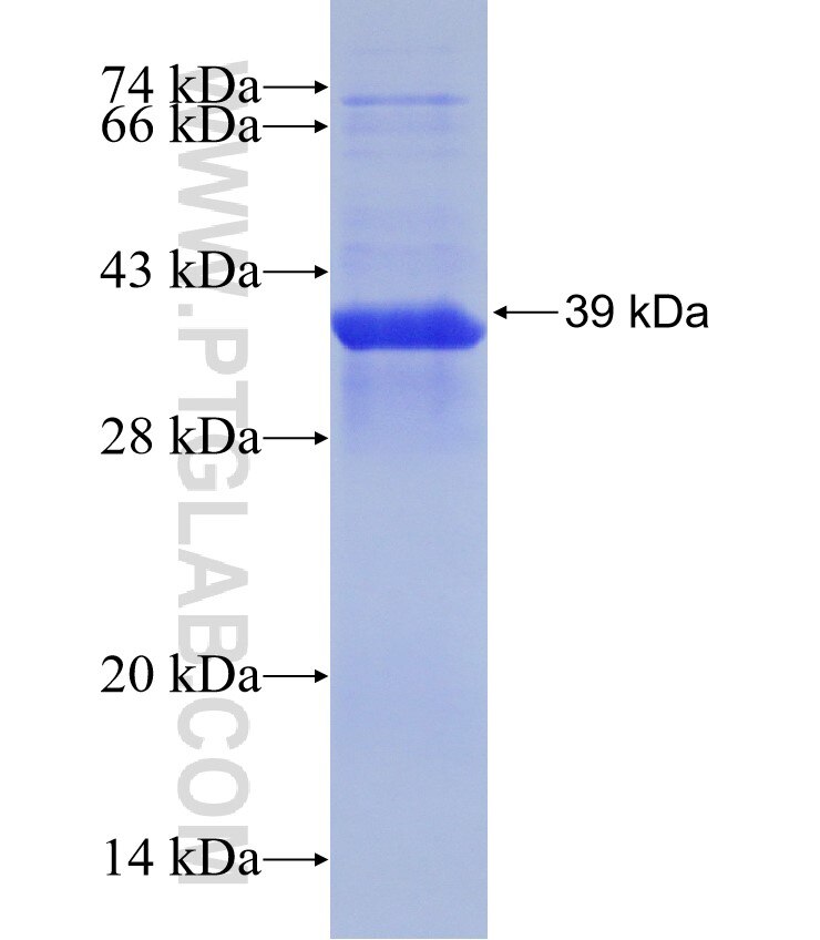 RPS23 fusion protein Ag31190 SDS-PAGE