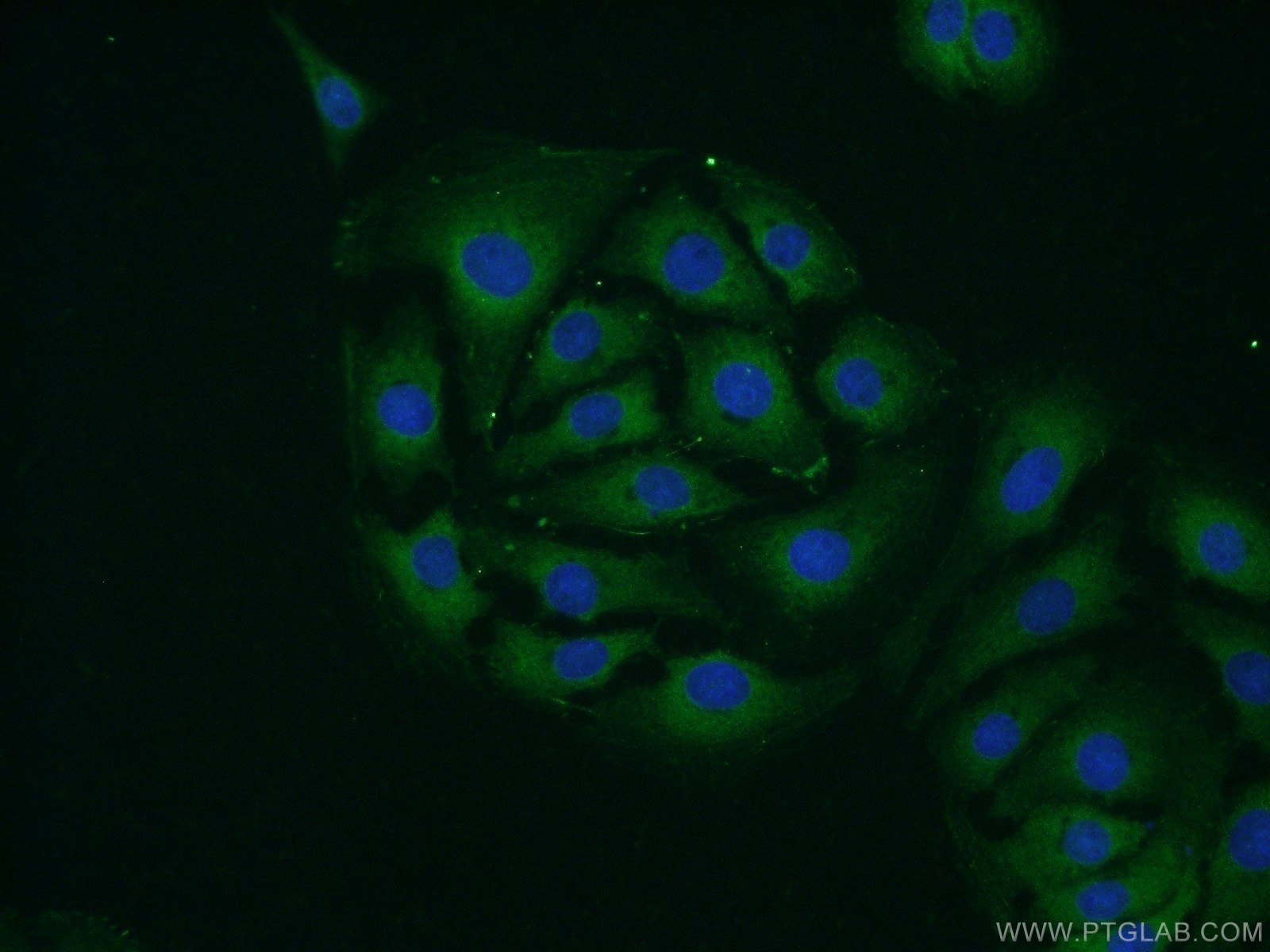 Immunofluorescence (IF) / fluorescent staining of SH-SY5Y cells using RPS24 Polyclonal antibody (14831-1-AP)
