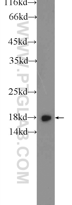 Western Blot (WB) analysis of SH-SY5Y cells using RPS24 Polyclonal antibody (14831-1-AP)