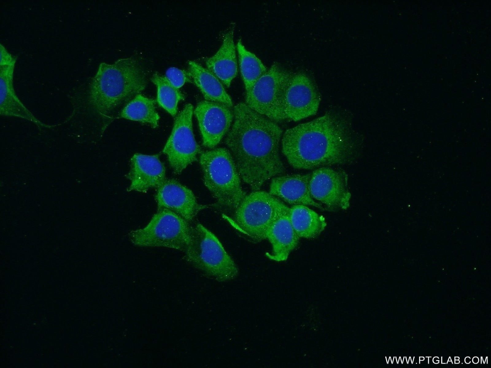 Immunofluorescence (IF) / fluorescent staining of MCF-7 cells using RPS25 Polyclonal antibody (23599-1-AP)