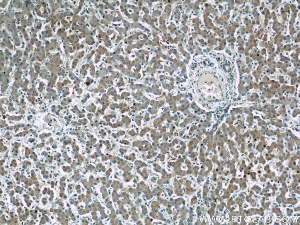 Immunohistochemistry (IHC) staining of human liver tissue using RPS25 Polyclonal antibody (23599-1-AP)