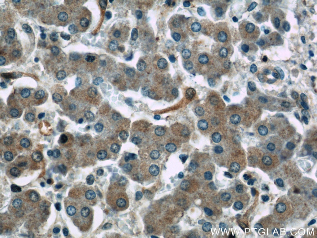 Immunohistochemistry (IHC) staining of human liver tissue using RPS25 Polyclonal antibody (23599-1-AP)