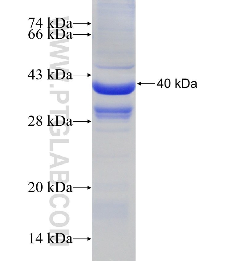 RPS25 fusion protein Ag7825 SDS-PAGE