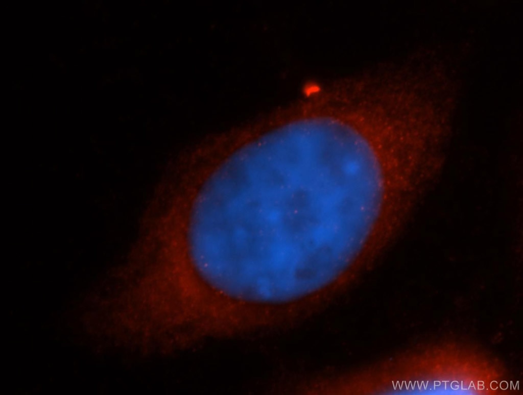 Immunofluorescence (IF) / fluorescent staining of MCF-7 cells using RPS26 Polyclonal antibody (14909-1-AP)