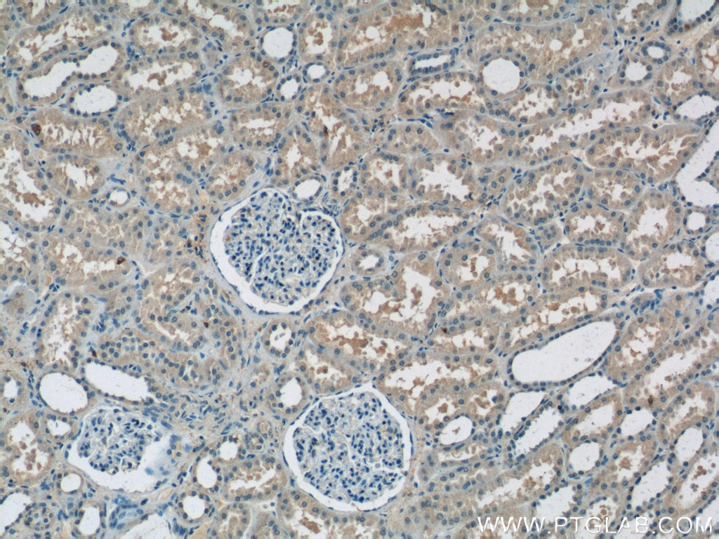 Immunohistochemistry (IHC) staining of human kidney tissue using RPS26 Polyclonal antibody (14909-1-AP)