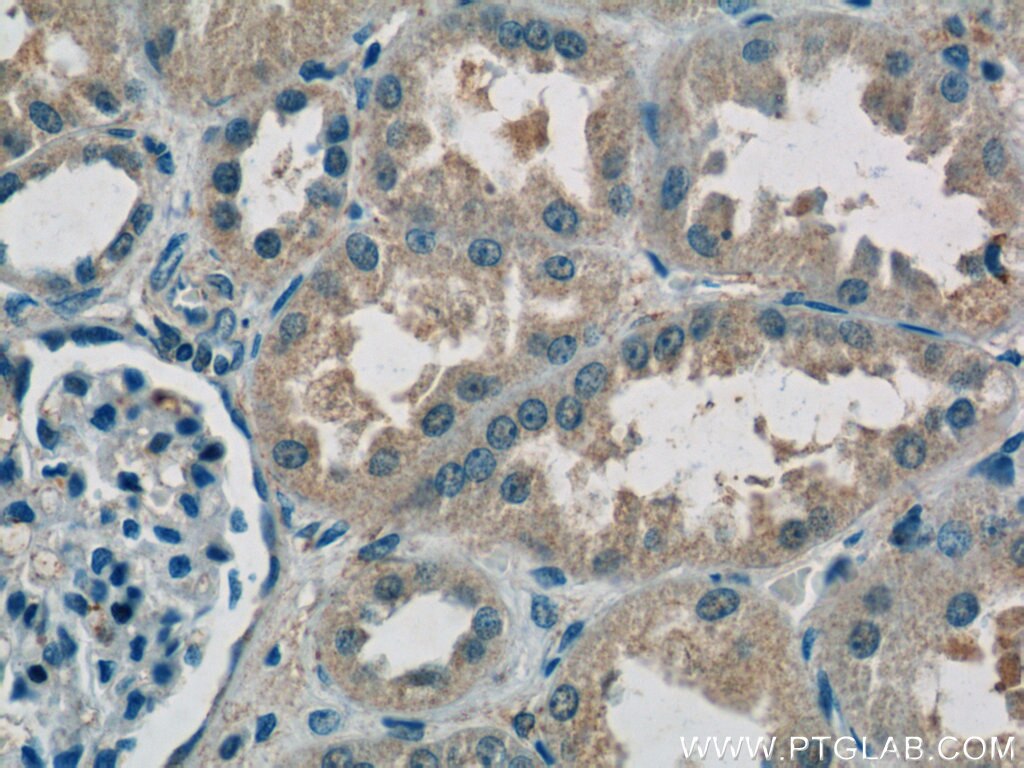 Immunohistochemistry (IHC) staining of human kidney tissue using RPS26 Polyclonal antibody (14909-1-AP)