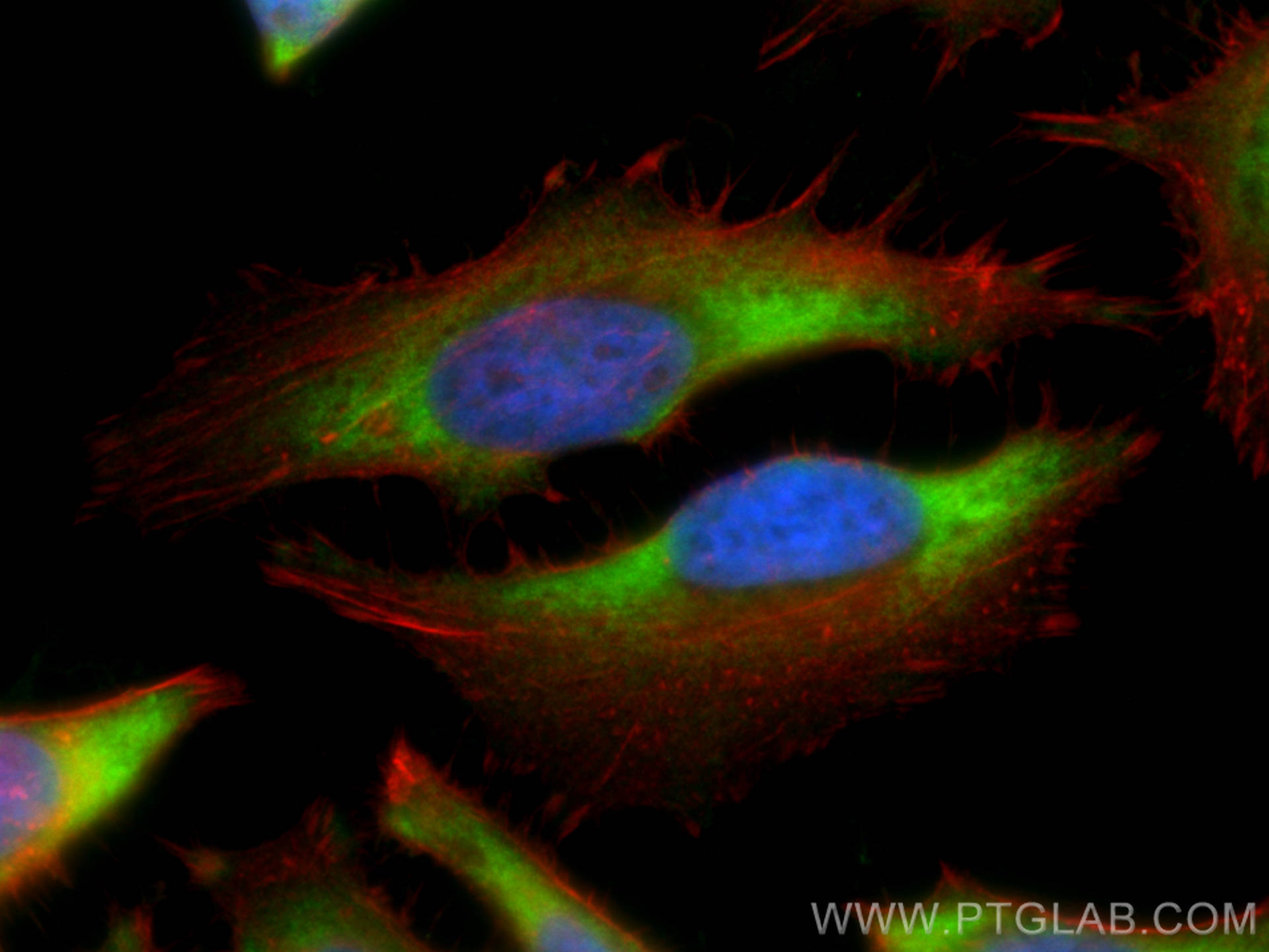 Immunofluorescence (IF) / fluorescent staining of HeLa cells using RPS27 Polyclonal antibody (15355-1-AP)