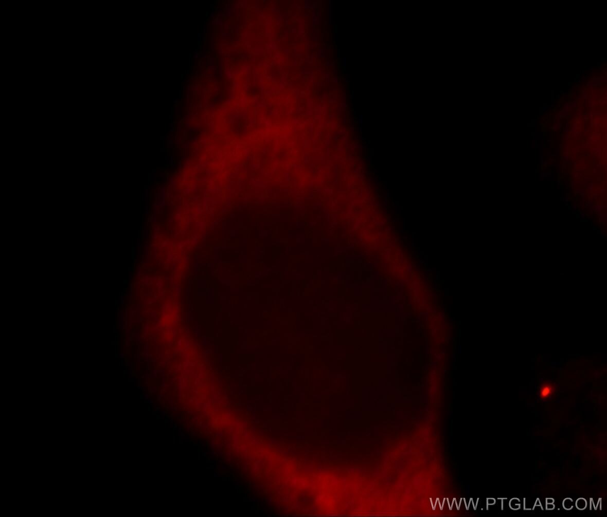Immunofluorescence (IF) / fluorescent staining of HeLa cells using RPS27 Polyclonal antibody (15355-1-AP)