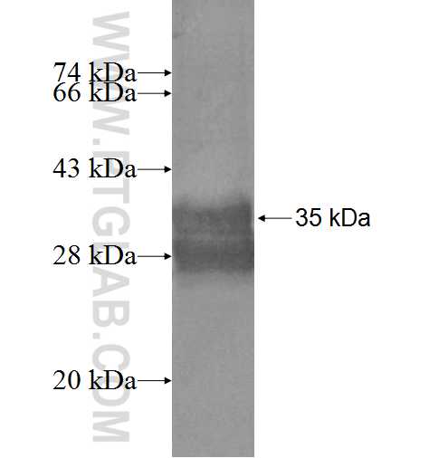 RPS27 fusion protein Ag7601 SDS-PAGE